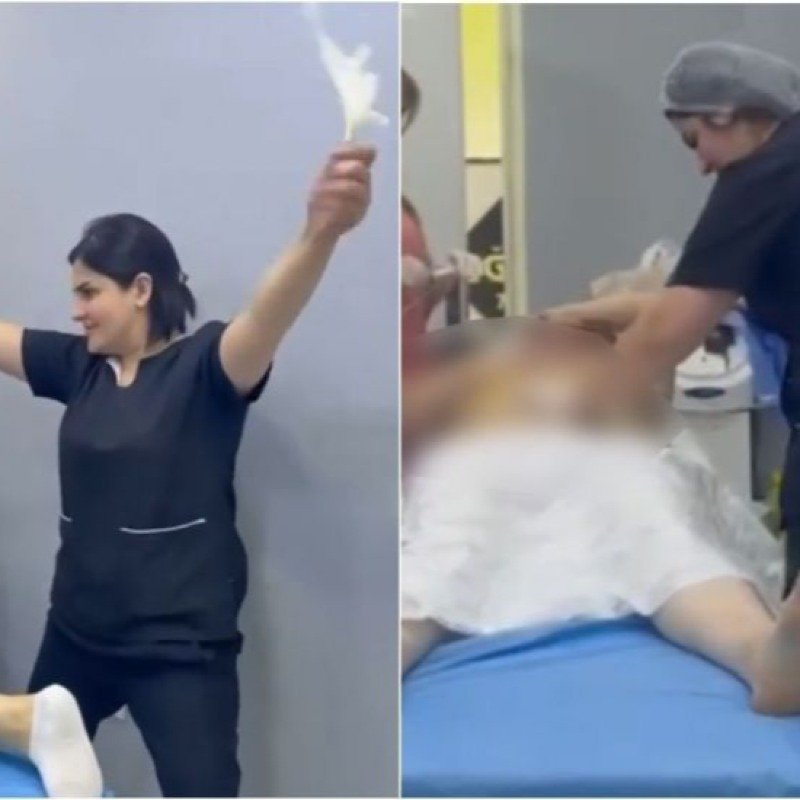 Qanunsuz estetik əməliyyat aparmaqda təqsirləndirilənlərin işi üzrə ittiham aktı elan olunub