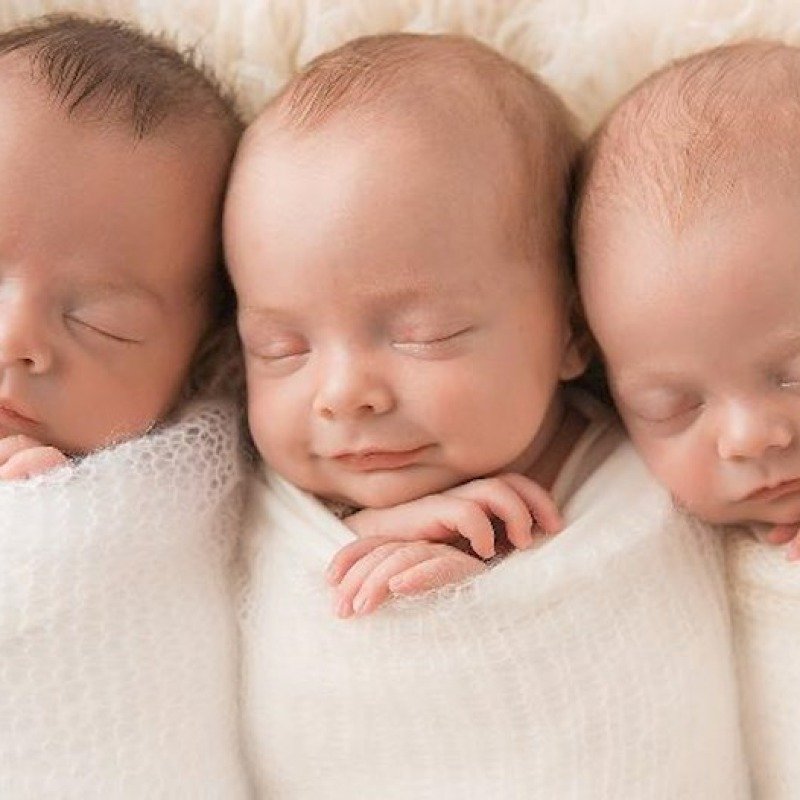 Azərbaycanda əkiz, üçəm və dördəmlərin sayı azalıb